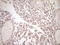 Tissue Factor Pathway Inhibitor antibody, LS-C790782, Lifespan Biosciences, Immunohistochemistry paraffin image 