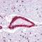BRCA1 DNA Repair Associated antibody, NB100-404, Novus Biologicals, Immunohistochemistry paraffin image 