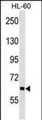 Ankyrin Repeat And KH Domain Containing 1 antibody, PA5-48746, Invitrogen Antibodies, Western Blot image 