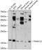 Thioredoxin Domain Containing 12 antibody, GTX66255, GeneTex, Western Blot image 