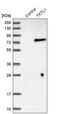 Transketolase Like 1 antibody, PA5-51394, Invitrogen Antibodies, Western Blot image 