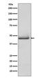 Caspase 9 antibody, M00080-1, Boster Biological Technology, Western Blot image 