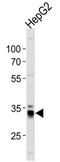 M-PST antibody, MBS9214145, MyBioSource, Western Blot image 