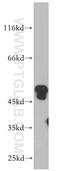 Ankyrin repeat and MYND domain-containing protein 2 antibody, 21065-1-AP, Proteintech Group, Western Blot image 