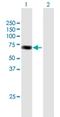 Acyl-CoA Dehydrogenase Family Member 9 antibody, H00028976-B01P, Novus Biologicals, Western Blot image 
