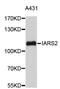 Isoleucyl-TRNA Synthetase 2, Mitochondrial antibody, STJ26907, St John