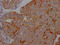 Mucin 16, Cell Surface Associated antibody, CSB-RA941216A0HU, Cusabio, Immunohistochemistry paraffin image 