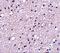 Tachykinin Receptor 3 antibody, A04916, Boster Biological Technology, Immunohistochemistry paraffin image 
