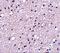 NK-3R antibody, A04916, Boster Biological Technology, Immunohistochemistry paraffin image 