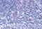 C-C Motif Chemokine Receptor 7 antibody, GTX78157, GeneTex, Immunohistochemistry paraffin image 