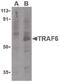 TNF Receptor Associated Factor 6 antibody, PA5-20019, Invitrogen Antibodies, Western Blot image 