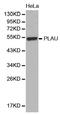 Plasminogen Activator, Urokinase antibody, orb136091, Biorbyt, Western Blot image 