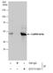 Calcium/Calmodulin Dependent Protein Kinase II Delta antibody, GTX111401, GeneTex, Immunoprecipitation image 