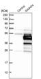 GTPase, IMAP Family Member 4 antibody, PA5-53935, Invitrogen Antibodies, Western Blot image 