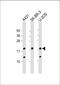 Thyroid Hormone Responsive antibody, 61-223, ProSci, Western Blot image 