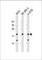 Thyroid hormone-inducible hepatic protein antibody, 61-223, ProSci, Western Blot image 