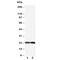 BCL2 Antagonist/Killer 1 antibody, R30507, NSJ Bioreagents, Western Blot image 