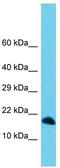 Chromosome 3 Open Reading Frame 36 antibody, TA330763, Origene, Western Blot image 