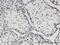 T-Box 22 antibody, H00050945-M01, Novus Biologicals, Immunohistochemistry paraffin image 