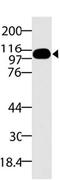 DExD/H-Box Helicase 58 antibody, MBS668020, MyBioSource, Western Blot image 