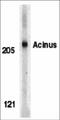 Apoptotic Chromatin Condensation Inducer 1 antibody, 2219, ProSci, Western Blot image 