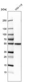 Matrix Metallopeptidase 1 antibody, HPA004920, Atlas Antibodies, Western Blot image 