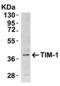 Hepatitis A Virus Cellular Receptor 1 antibody, 3809, ProSci, Western Blot image 