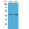 Layilin antibody, LS-C386981, Lifespan Biosciences, Western Blot image 