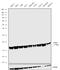 NME/NM23 Nucleoside Diphosphate Kinase 1 antibody, 711457, Invitrogen Antibodies, Western Blot image 