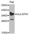 Major Histocompatibility Complex, Class II, DP Alpha 1 antibody, STJ24023, St John