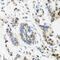 DNA Topoisomerase I antibody, 23-147, ProSci, Immunoprecipitation image 
