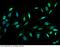 SWI/SNF Related, Matrix Associated, Actin Dependent Regulator Of Chromatin Subfamily C Member 2 antibody, 101577-T02, Sino Biological, Immunohistochemistry paraffin image 