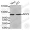 NOP2 Nucleolar Protein antibody, A5878, ABclonal Technology, Western Blot image 