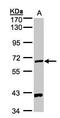 Pantothenate kinase 1 antibody, PA5-21707, Invitrogen Antibodies, Western Blot image 