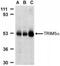 Tripartite Motif Containing 5 antibody, NBP1-76600, Novus Biologicals, Western Blot image 