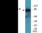 Protein Kinase C Theta antibody, EKC2176, Boster Biological Technology, Western Blot image 