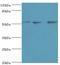 Annexin A7 antibody, LS-C375210, Lifespan Biosciences, Western Blot image 