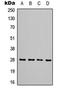 TIMP Metallopeptidase Inhibitor 1 antibody, LS-C368646, Lifespan Biosciences, Western Blot image 