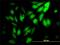 WD Repeat Domain 5 antibody, H00011091-M01, Novus Biologicals, Immunocytochemistry image 