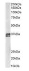 Musashi RNA Binding Protein 2 antibody, orb195346, Biorbyt, Western Blot image 