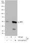 Interferon Regulatory Factor 4 antibody, GTX129135, GeneTex, Immunoprecipitation image 