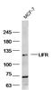 LIF Receptor Subunit Alpha antibody, GTX60183, GeneTex, Western Blot image 