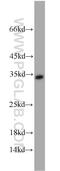 Replication Protein A2 antibody, 10412-1-AP, Proteintech Group, Western Blot image 