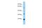 Coronin 1B antibody, PA5-46001, Invitrogen Antibodies, Western Blot image 