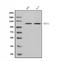 Transient Receptor Potential Cation Channel Subfamily A Member 1 antibody, A00453-2, Boster Biological Technology, Western Blot image 