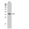 PDZ And LIM Domain 1 antibody, LS-C382776, Lifespan Biosciences, Western Blot image 