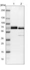 TNF Receptor Associated Factor 6 antibody, NBP1-80826, Novus Biologicals, Western Blot image 