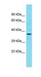 Rho Guanine Nucleotide Exchange Factor 39 antibody, orb326835, Biorbyt, Western Blot image 