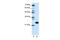 Ribosomal Protein L13 antibody, ARP40217_P050, Aviva Systems Biology, Western Blot image 