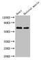 Liver carboxylesterase 1 antibody, CSB-PA005258LA01HU, Cusabio, Western Blot image 